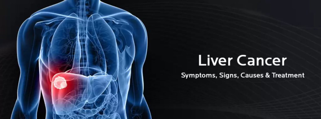Symptoms of liver cancer