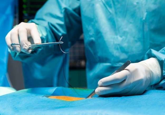 Surgical Interventions for Biliary Conditions