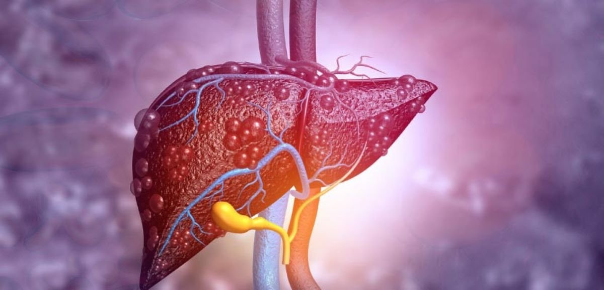 What Are Elevated or Abnormal Liver Enzyme Levels?